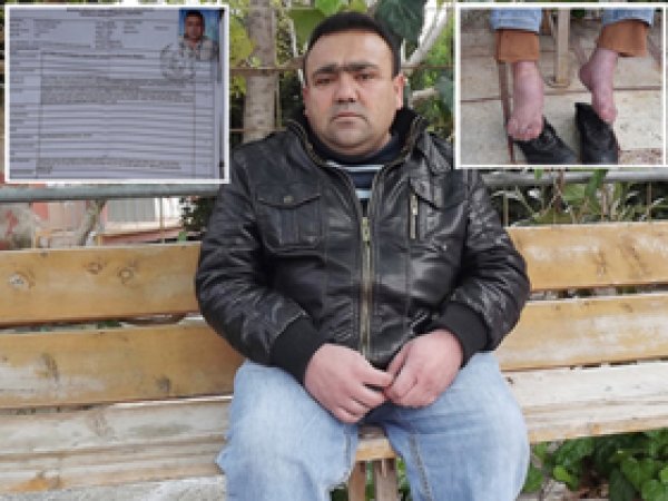 Özürlü Olduğu İçin İş Bulamıyor