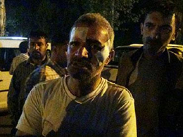 'PKK/BDP'liler Organizeli Bir Şekilde Bize Saldırdılar'