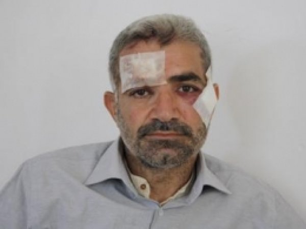 Mağdurlar Olay Anını Anlattı