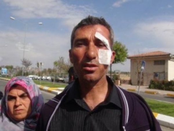 "Bu Kaza Değil Öldürmeye Teşebbüs" 