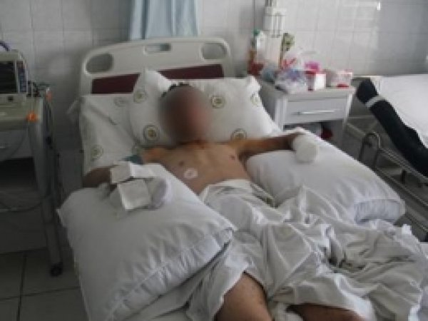 Elinde Bomba Patlayan Genç Konuştu 