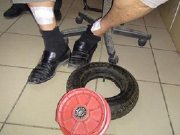 Halk Otobüsünde Lastik Patladı: 1 Yaralı