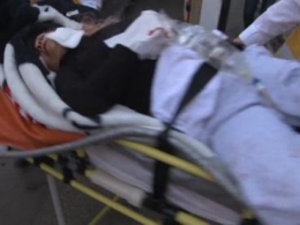 Eşini 30 Yerinden Bıçakladı 