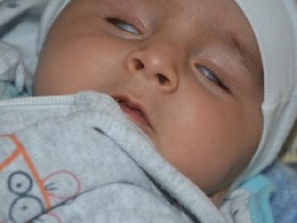 Minik Yusuf Nakil için Sıra Bekliyor 