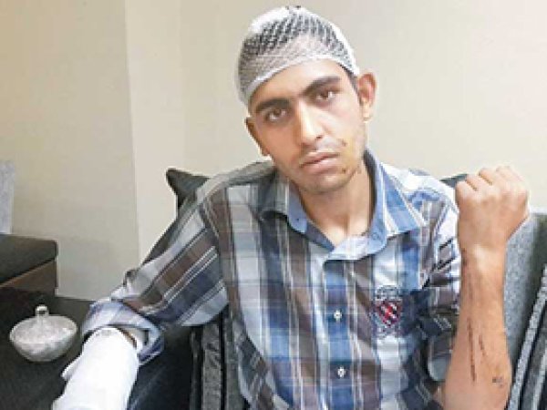 Vahşetin Tanığı Yusuf Er'in Anlattıkları Kan Dondurdu!