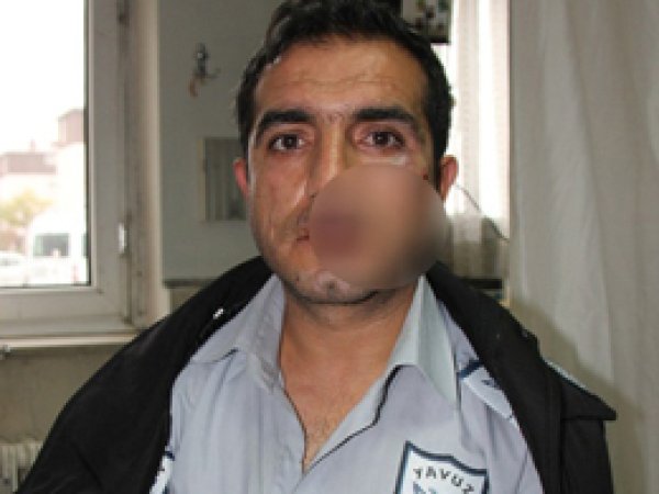 Uzman Çavuş, Güvenlikçiyi Darp Etti İddiası 