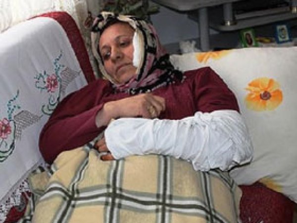 Aday Gösterilmeyen BDP'li Kadın Kendini Ateşe Verdi
