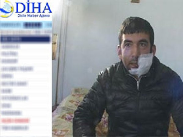 PKK Medyasından, Hizbullah'a Falçata İftirası