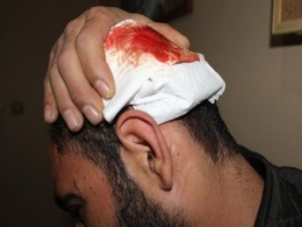 PKK/BDP'liler Suçüstü Yakalanınca HÜDA PAR'a Saldırdılar