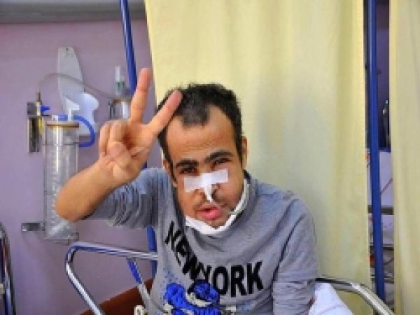 Biber Gazıdan Kanser Olduğu İddia Edilen Şahıs Hayatını Kaybetti 