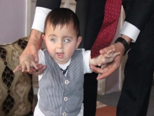 Minik Abdullah Artık Ameliyat Olabilecek 