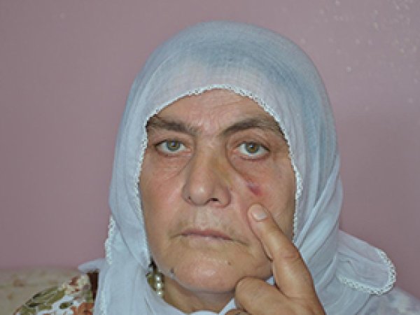 PKK'liler Rızkiye Adiyaman'a Yumruk Atmışlar