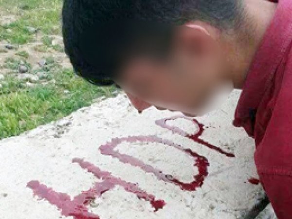 Dövdükleri çocuğun kanıyla HDP yazdılar
