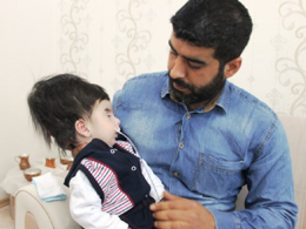 'Hidrosefali hastası bebek ölüme terk edildi''