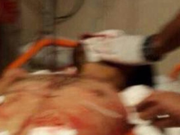 Nusaybin'de yaralan genç hayatını kaybetti
