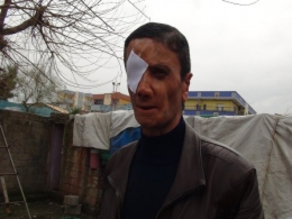 Doğuştan yürüme engelli kardeşler yardım bekliyor