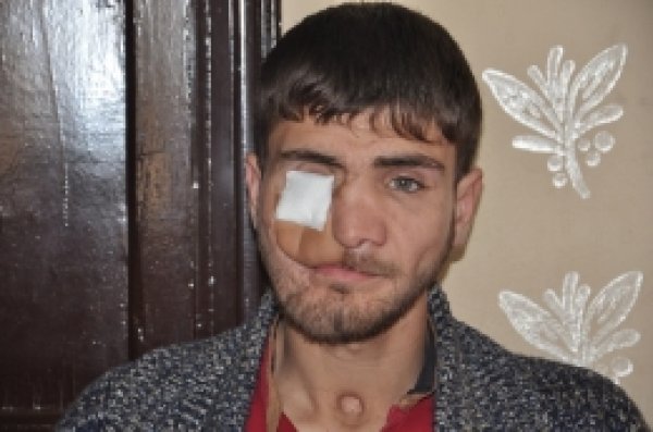 Tek isteği estetik olup işe girebilmek