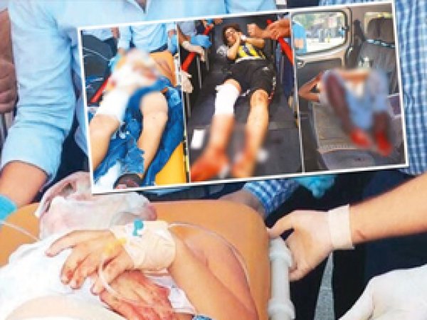 PKK Sur’da çocukları vurdu