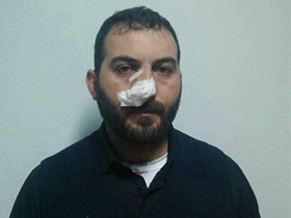 Radyocu Dağtekin'in evine bombalı saldırı