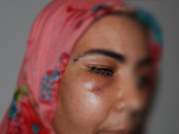 'PKK insanları yaşamaktan bıktırdı'