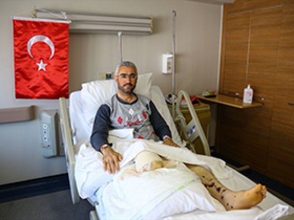 Darbecilere direnen imam, bacağını kaybetti 