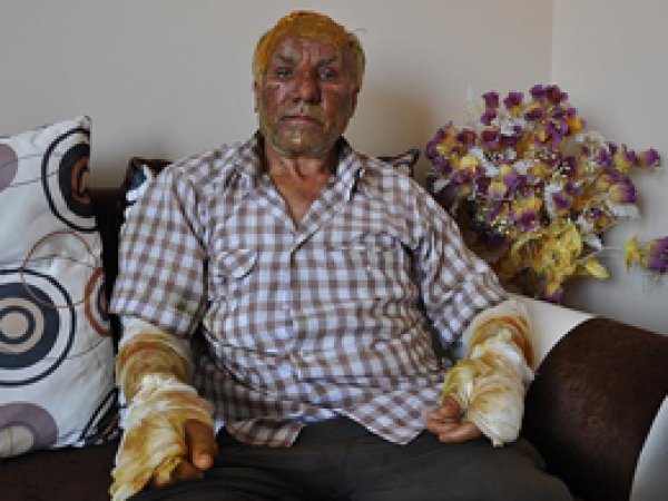 PKK'nın insanlıkla alakası yok