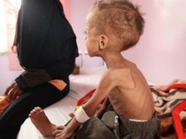Yemen'de çocuk ölümleri ikiye katlandı