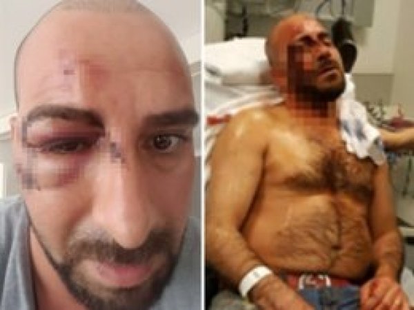 Belçika’da ırkçılar Türkiye vatandaşını darp etti