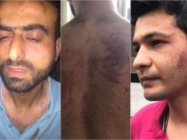 Polis şiddetine ilişkin suç duyurusunda bulunulacak