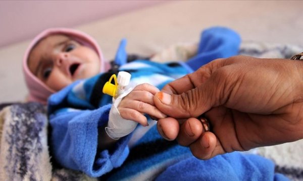 UNICEF: Yemen'de 12 milyon çocuk acil yardıma muhtaç