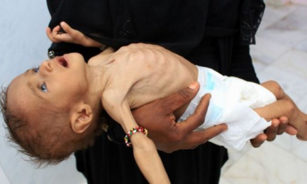 Yemen'de yüzbinlerce ailenin yararlandığı yardım programı askıya alındı