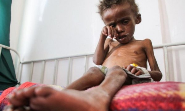 BM: Yemen'de bir nesil tamamen yok olma tehlikesiyle karşı karşıya