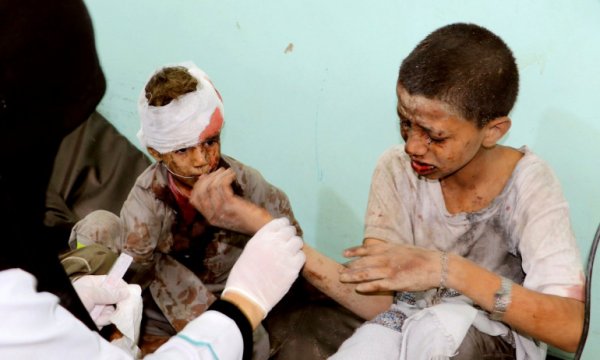 'BM, Suudi-BAE Koalisyonunu Yemen’deki suçlarından aklamaya çalışıyor'