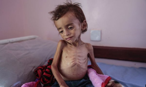 BM: Yemen'de halk açlıktan ölüyor