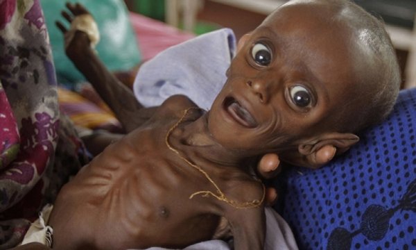 Somali'de 1,3 milyon kişi acil gıda yardımına ihtiyaç duyuyor