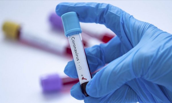 Dünyada Koronavirüs bulaşan kişi sayısı 85 bini aştı hangi ülkede kaç hasta var?