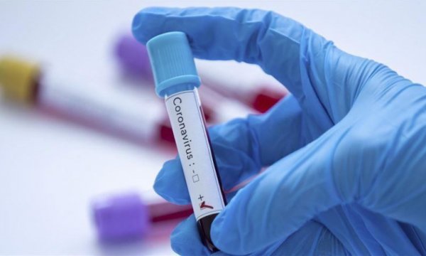 Dünya genelinde Kovid-19 bulaşan kişi sayısı 246 bini geçti 