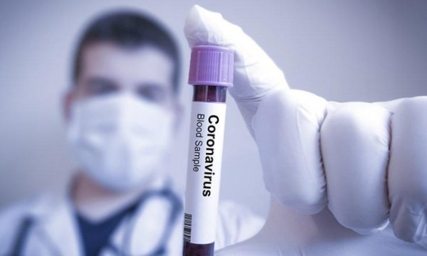 Dünya genelinde Kovid-19 bulaşan kişi sayısı 860 bini geçti