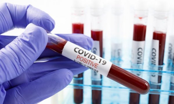 Dünya genelinde Kovid-19 vaka sayısı 1 milyon 700 bini aştı