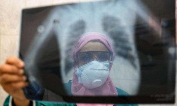 Hindistan'da 1 günde en yüksek Kovid-19 vakası tespit edildi 