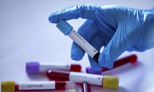Dünya genelinde Kovid-19 bulaşan kişi sayısı 2 milyon 995 bini geride bıraktı