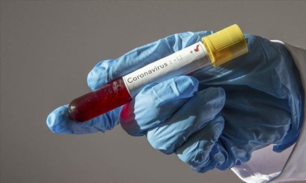 Hollanda'da Kovid-19 nedeniyle ölenlerin sayısı 4 bin 795'e çıktı