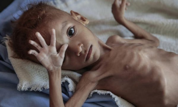 BM'den uluslararası topluma acil 'Yemen' çağrısı
