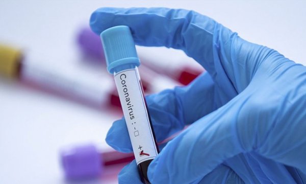 Almanya’nın Türkiye’deki Kovid-19 testlerini tanıma kararı Türkler tarafından olumlu karşılandı