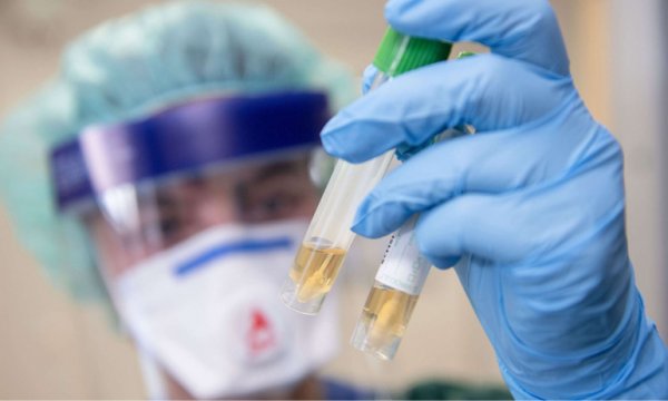 Dünya genelinde Kovid-19 tespit edilen kişi sayısı 11 milyon 205 bini geçti