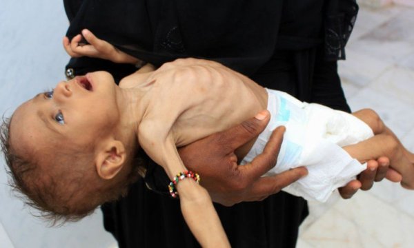 BM: Yemen'de insani durum son derece kaygı verici
