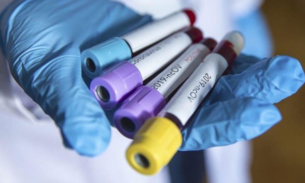 Türkiye'de son 24 saatte 992 kişiye Kovid-19 tanısı konuldu