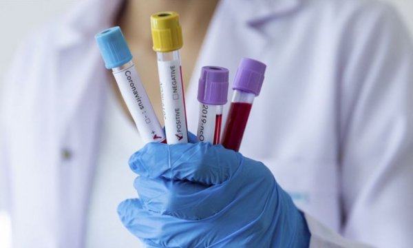  Rusya'dan, Koronavirüs aşı açıklaması