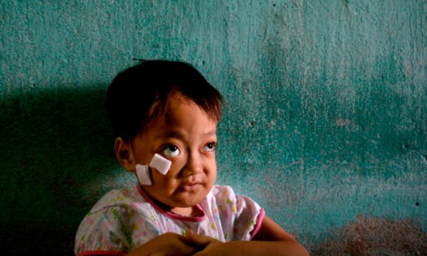 Vietnam'da Amerikan saldırıları sebebiyle engelli doğumlar sürüyor
