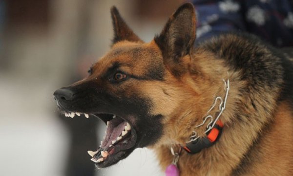 Yılda 35 bin kişi köpek saldırılarında hayatını kaybediyor 